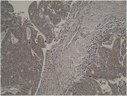 LRAT Mouse anti-Human, Mouse, Rat, Clone: M34-P1F10, MilliporeSigma 100 &mu;g | Buy Online | MilliporeSigma | Fisher Scientific